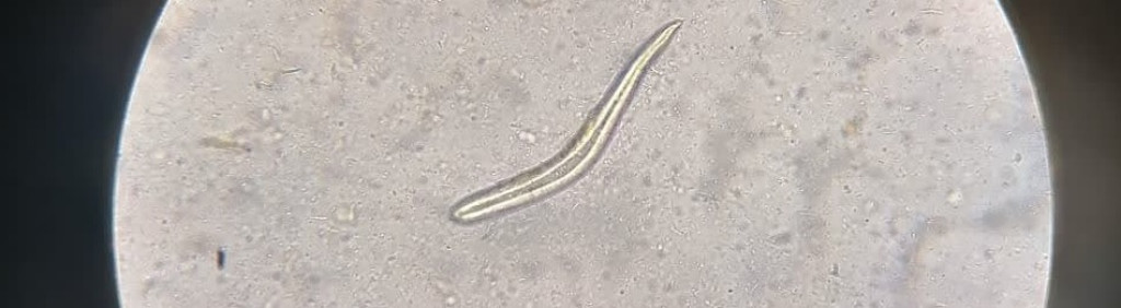 لارو کرمک اکسیور (Pinworm) در نمونه یک جوان 24 ساله که تصمیم به افتتاح نانوایی داشت